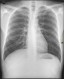 Radiographie — Wikipédia