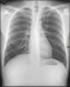 Radiographie — Wikipédia